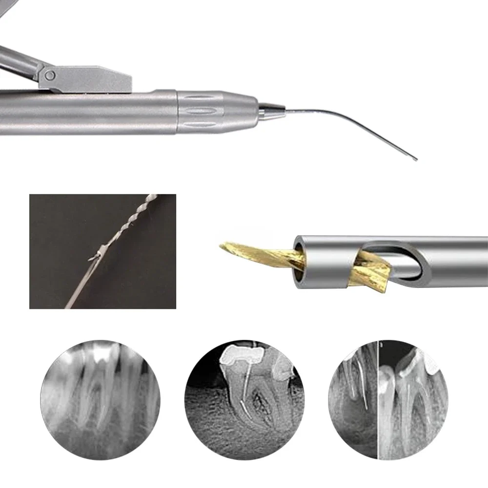 Ekstraktor pilników dentystycznych Zestaw do usuwania uszkodzonych pilników Instrument do terapii pilnikami kanałowymi Narzędzia do endodontyki — zdjęcie 2