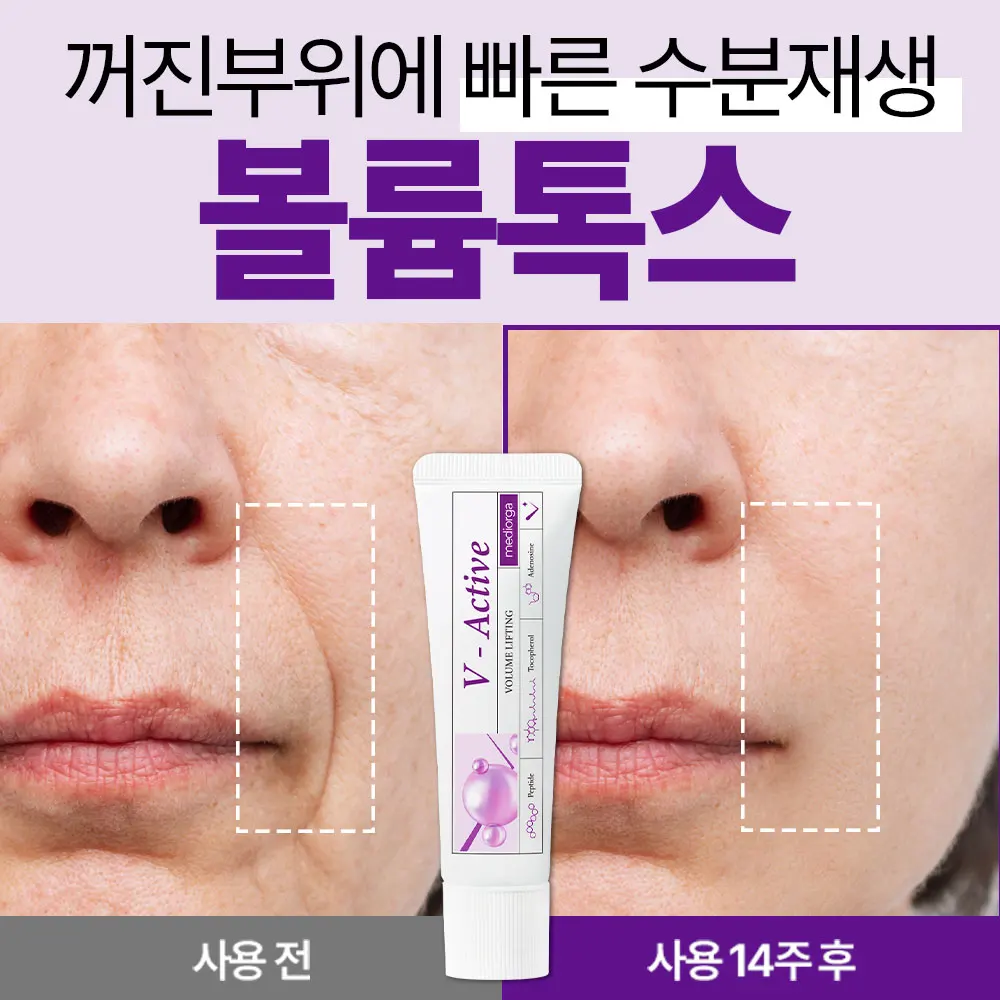 [Self Sale] Moist Moisture Filled Tribes Skin Tone Improvement Melasma Mushroom Blemish Wrinkle Elasticity White Jade Daily V-Active Nourishing Cream