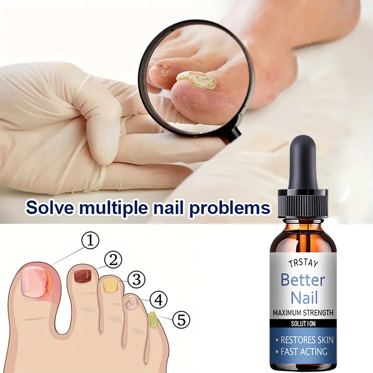 زيت مغذي لزوائد الأظافر من TRSTAY 50 مل يغذي ويصلح الأظافر التالفة وترطيبها ويقوي ويضيء العناية بالأظافر