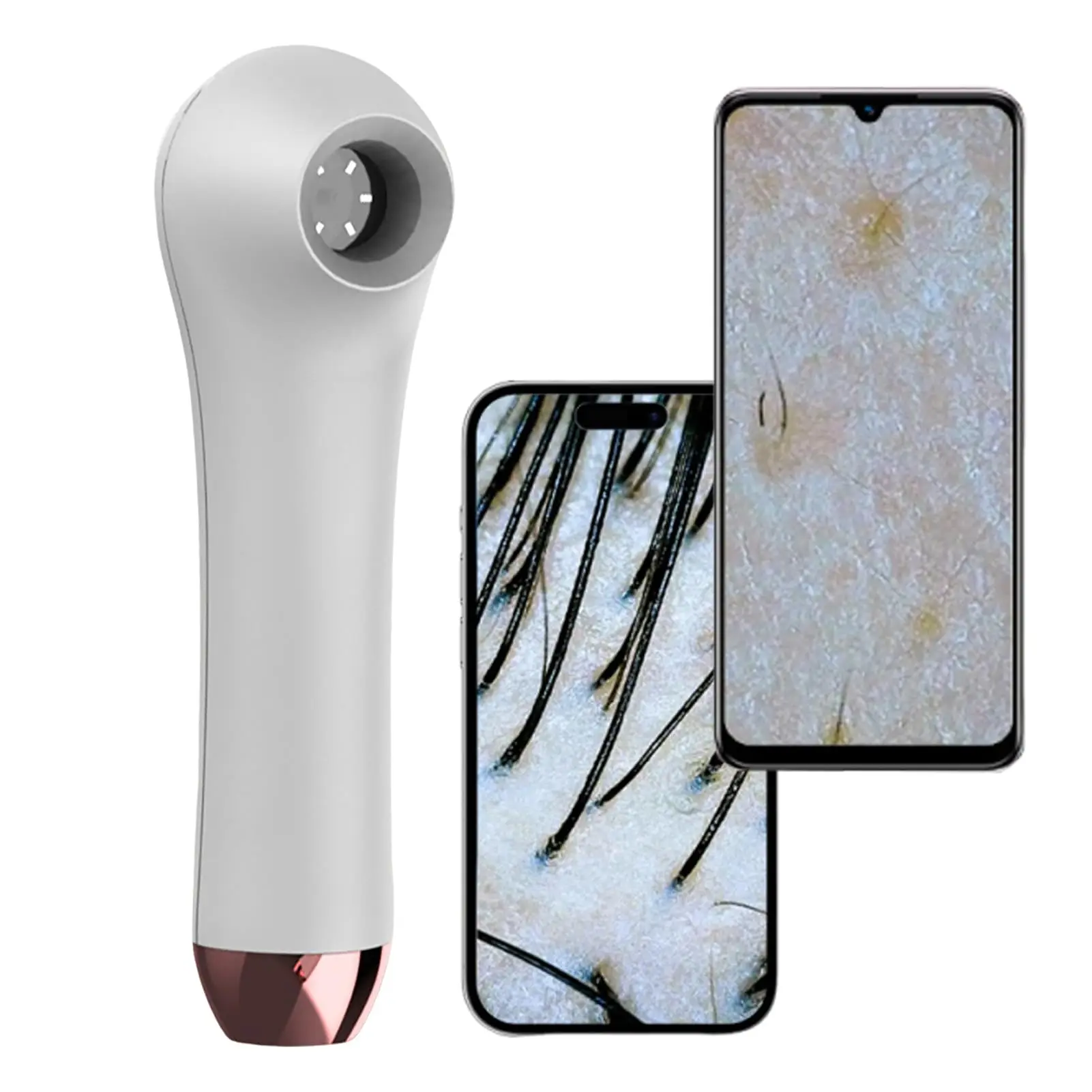 Smart Scalp Analyzer Hair Follicle Detector Digital Microscope Camera with HD 1MP Lens 4X Magnification Skin Analyzer for Hair Root Scalp Health Inspection Acne Pore Oil Skin Testing Compatible with iOS Android Phone App Connection Portable Beauty Care De