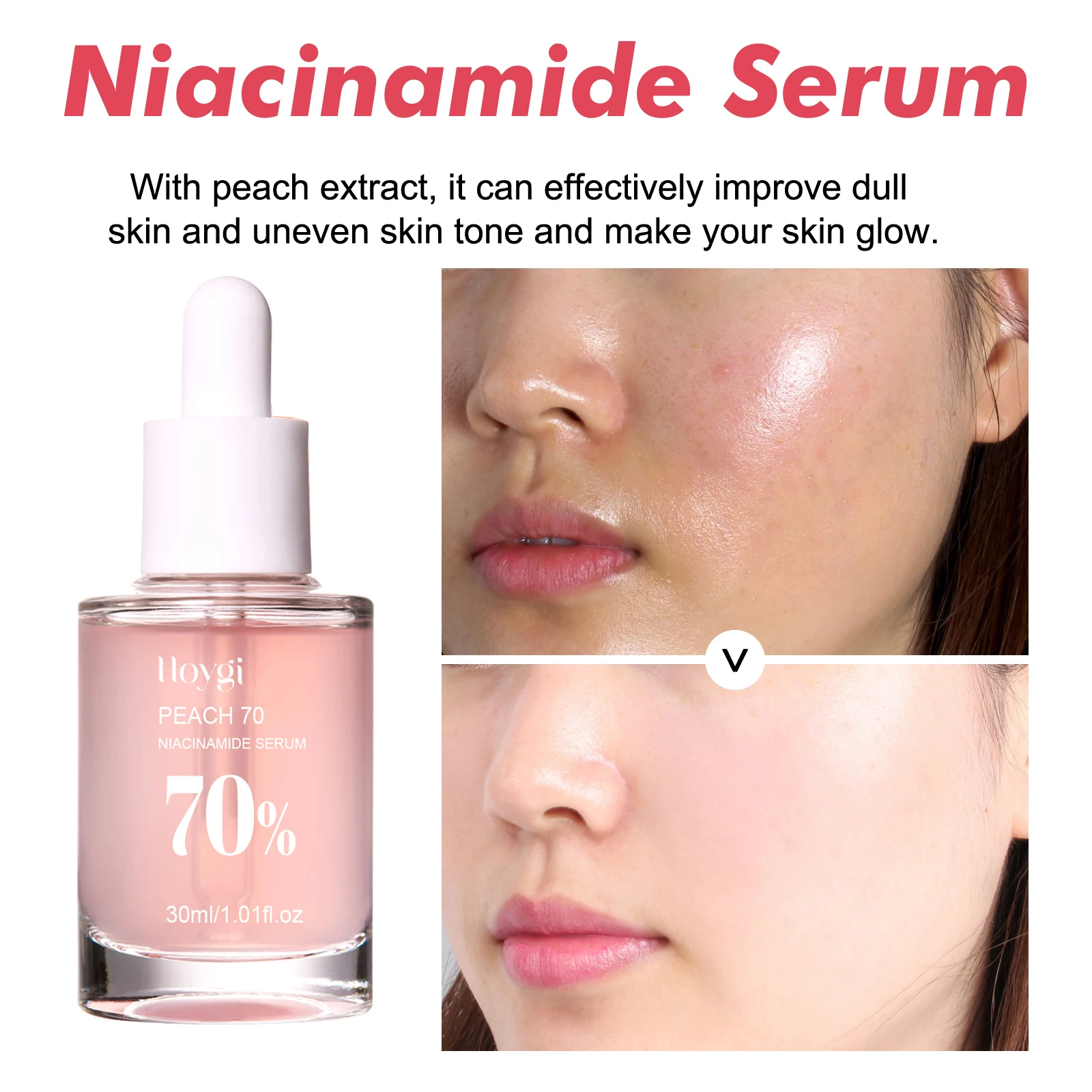 مصل Hoygi Niacinamide للوجه لشد البشرة وتلاشي الخطوط الدقيقة وتقليص المسام وإزالة البقع الداكنة وتنعيم البشرة وسيروم الوجه المتوهج