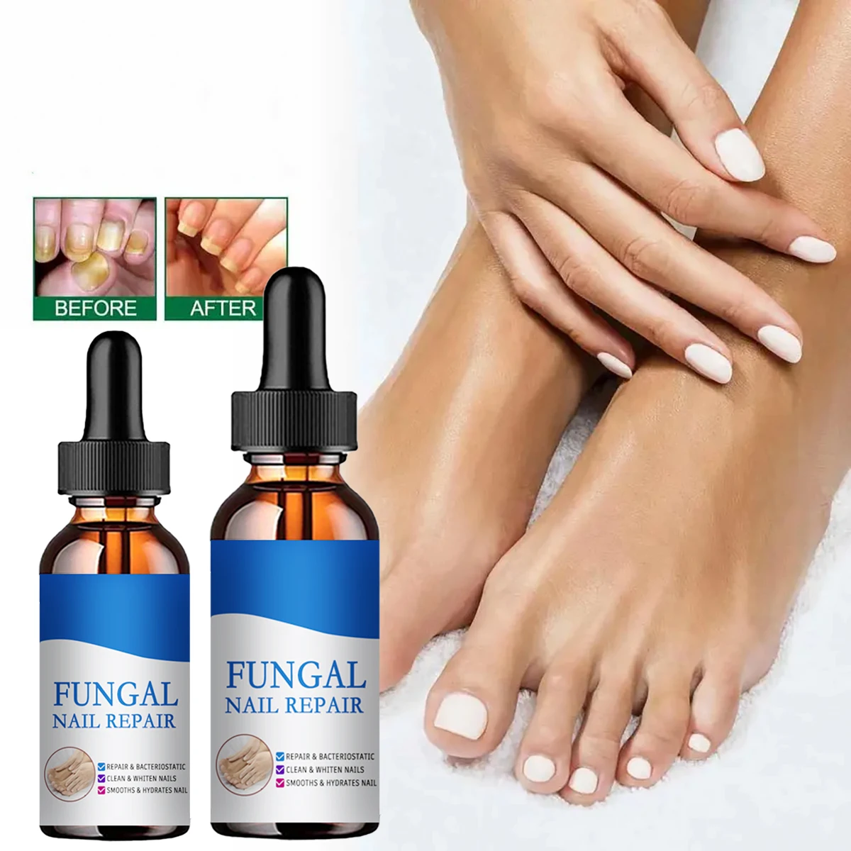 Trstay tratamento de fungos nas unhas, reparação de pés, essência, clareamento das unhas dos pés, remoção de fungos, gel anti-infecção, cuidados de saúde