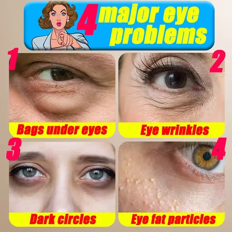 Puffiness Away Work Under Eyes Bag Remover