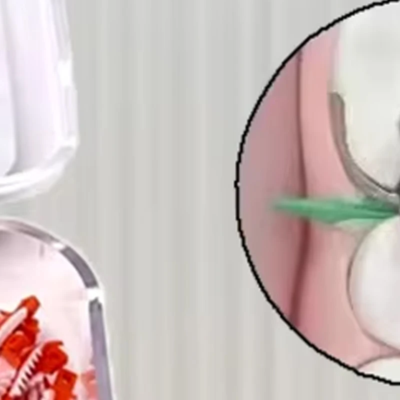 

Dental Matrix Wedges Soft Cervical System for Composite Fillings Endodontics Disposable Woodless Wedges Tooth Gap