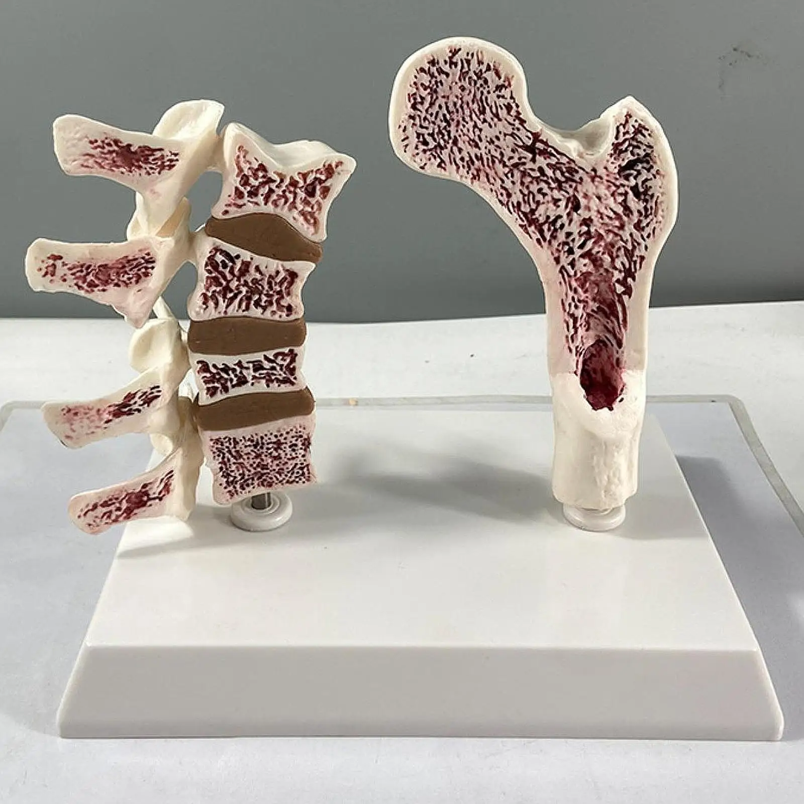 

Анатомическая модель остеопороза человека, обучающий реквизит, анатомический дисплей скелетных позвонков для домашнего класса