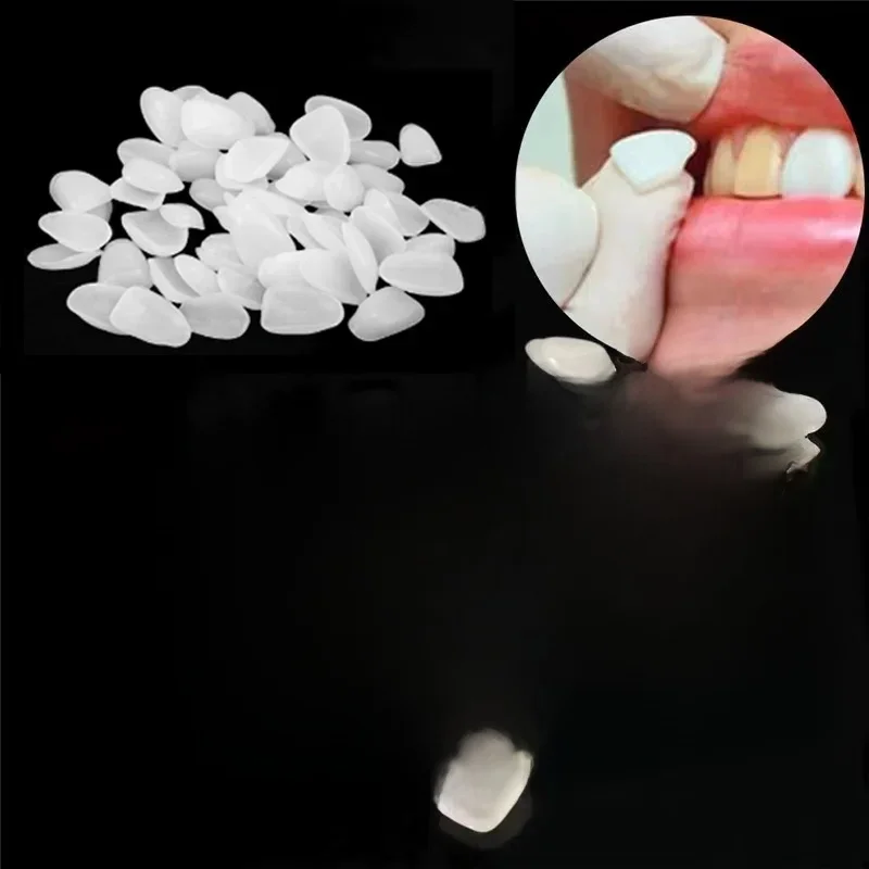 500 pièces placages de dents résine couronne temporaire Ultra mince réparation ensembles de blanchiment dentiste faux dents soins bucco-dentaires matériaux de nettoyage