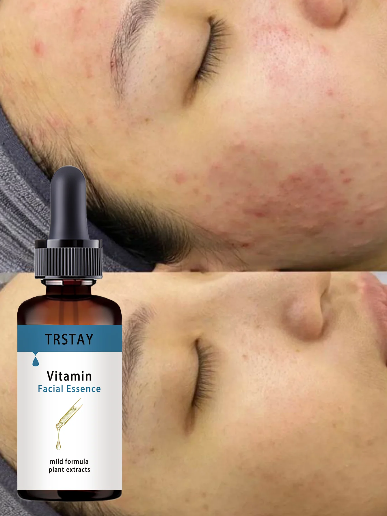 Hydrating Warmth Activated Facial Oil For Better Absorption Deep Moisturizing Serum Nourishing Skin Care Treatment For All Skin - Image 2