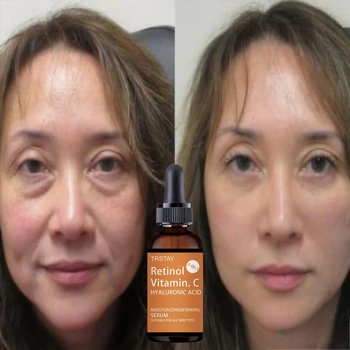 Multi effect anti wrinkle essence milk deeply moisturizes fights dullness tightens skin brightens complexion for youthful glow l - Image 2