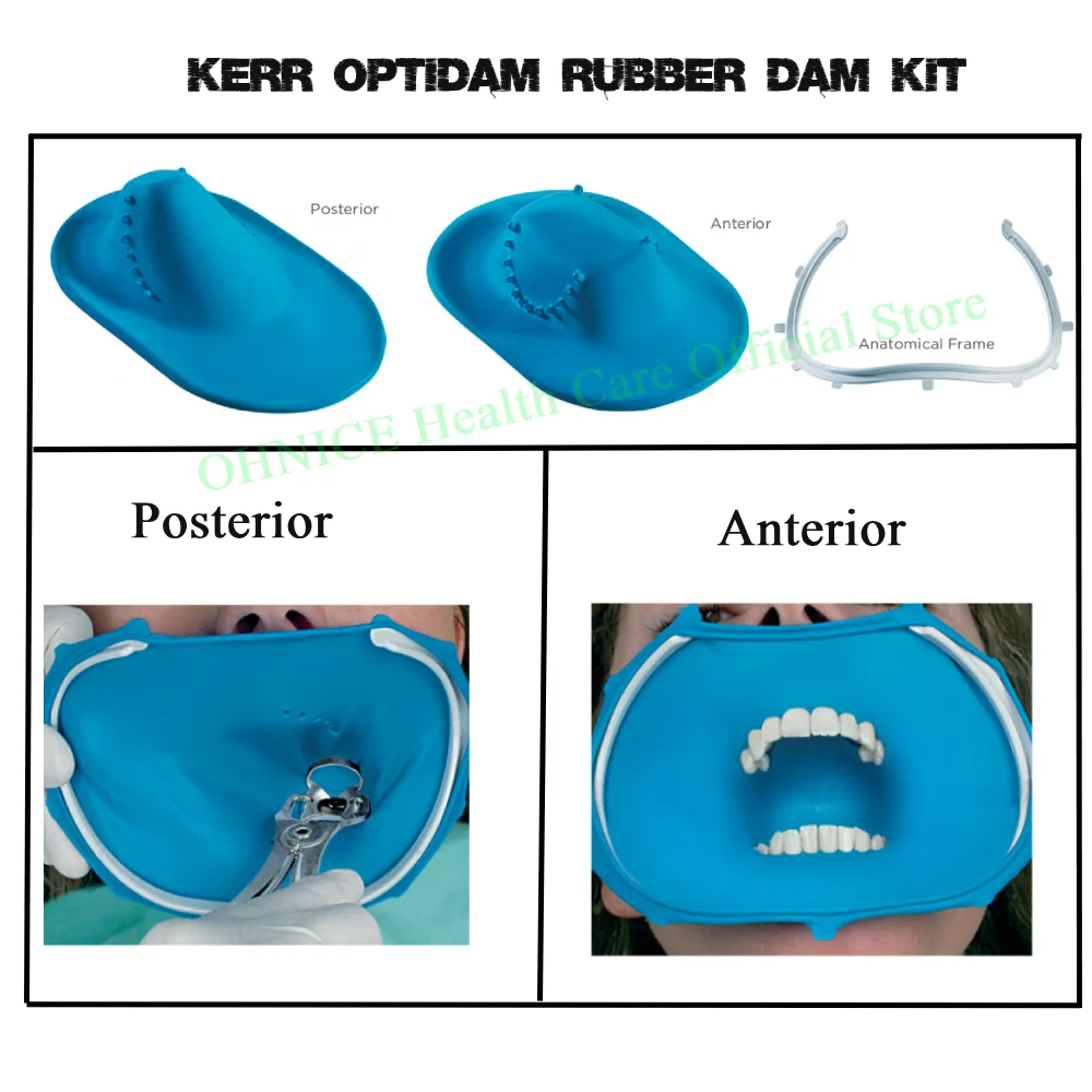

Kerr OptiDam Rubber Dam Kit - Natural Latex Sheet & Frame for Anterior/Posterior Teeth, Intro Set for Dental Procedures