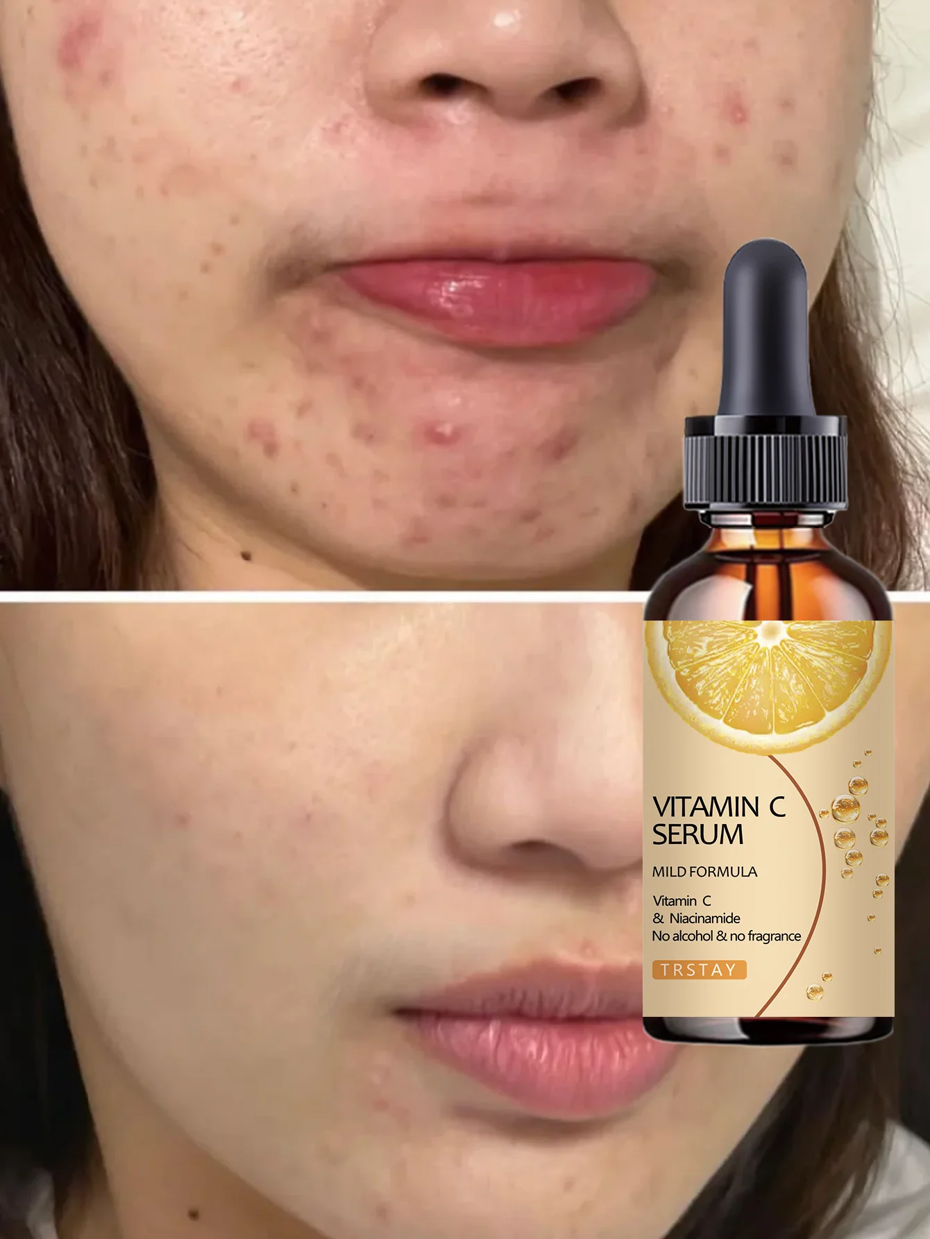 Hydrating Lightweight Serum Deeply Moisturizes Enhances Skin Firmness Creates Plump Youthful Skin Smooth Soothing Treatment for