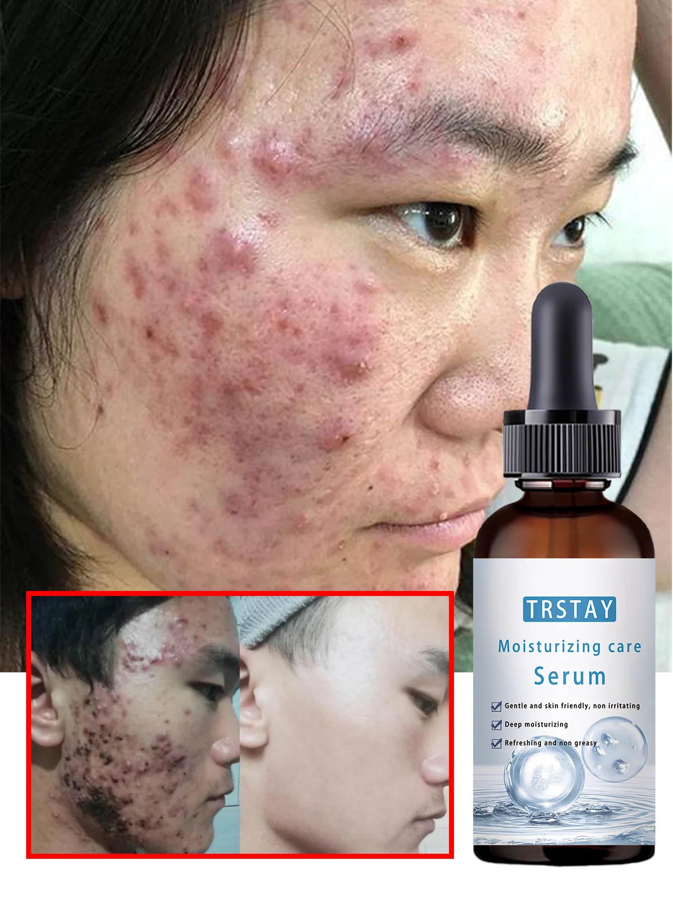 All Skin Types Brightening Serum Hydrates and Fights Acne Boosts Skin Elasticity Reduces Dryness and Looseness for Youthful Glow - Image 2