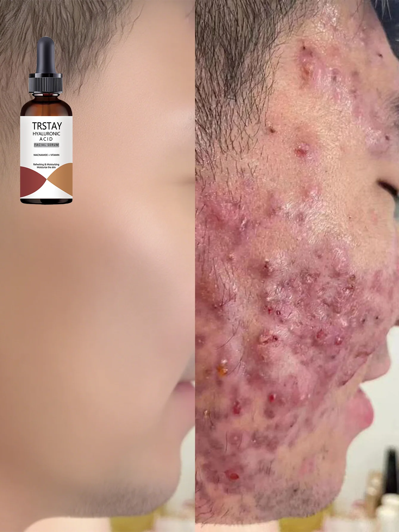 Hydrating Facial Oil for Daily Moisture Boost with Natural Ingredients for Deep Nourishment and Radiant Skin All Day Long - Image 5