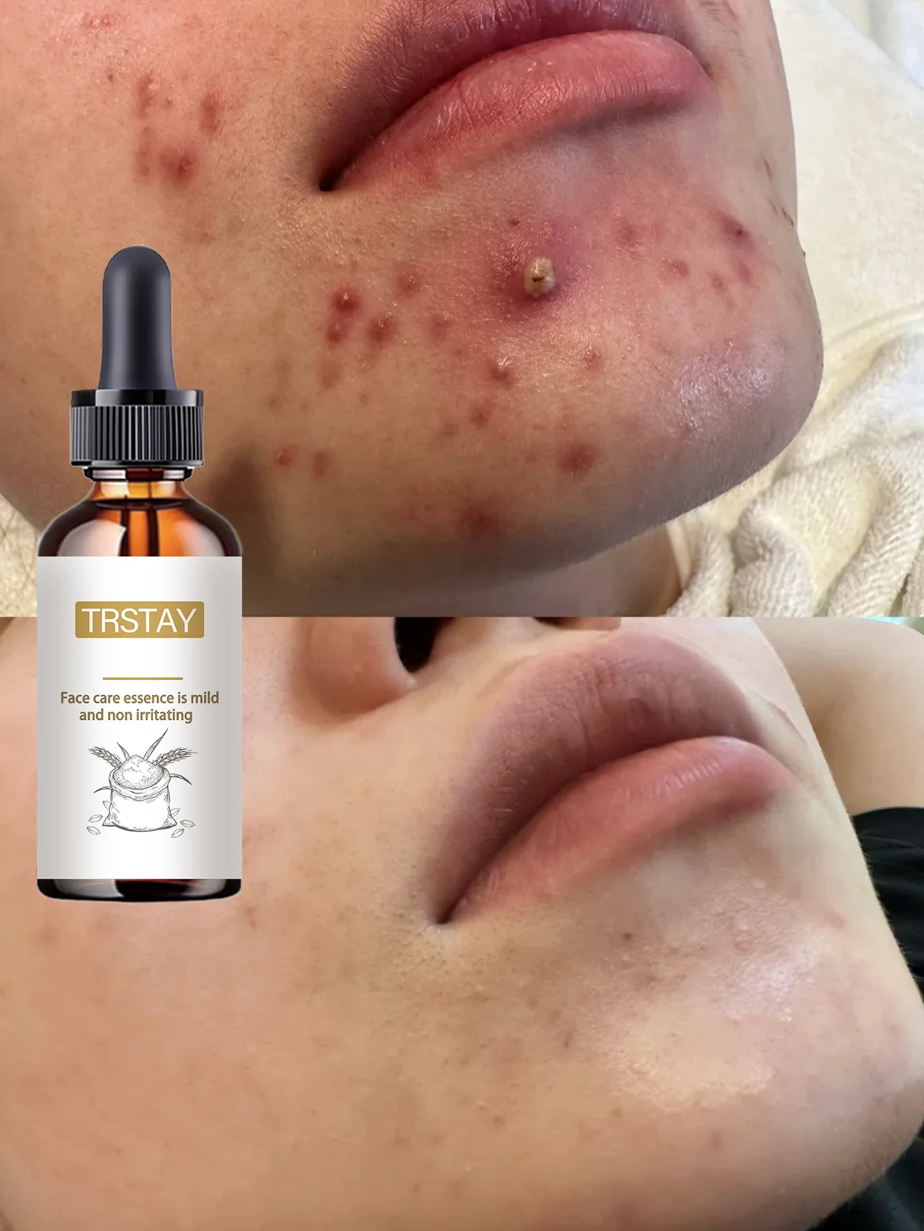 Moisturizing Spot Lightening And Skin Brightening Essence With Hydrating Formula To Even Skin Tone And Enhance Glow For Radiant - Image 5