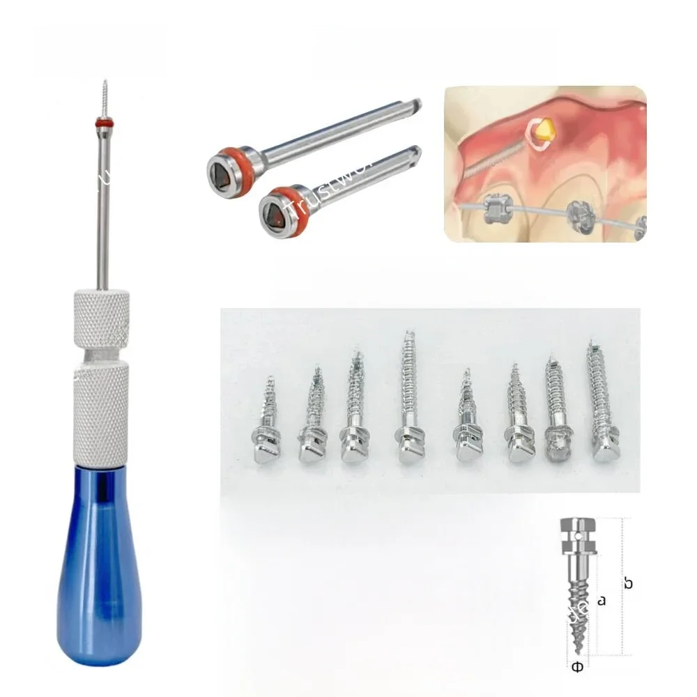 Dental tymczasowy system kotwiczenia Mini zestawy śrub mikro implantów ortodontyczny sterownik uchwytu TAD śruby trójkątne pasuje do wektorowego TAS — 2