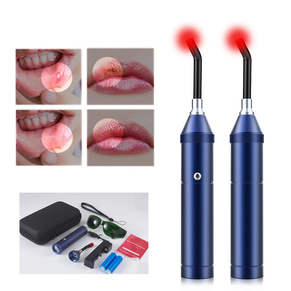 

Infrared Light Treatment Device Lamp Cold Ulcer Infrared Physiotherapy Laser Therapy for Mouth Nose Ear Knee Feet Hands Ankle