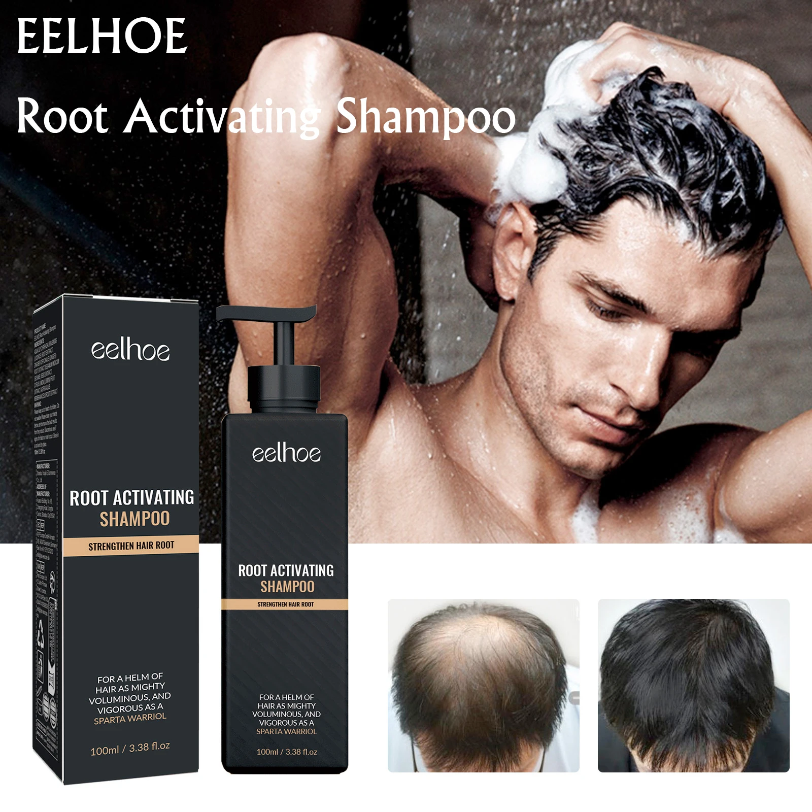 

EELHOE Root Activating Shampoo Regrowth Treatment Anti Hairs Loss Strengthen Nourishing Roots Oil Control Hair Growth Shampoo