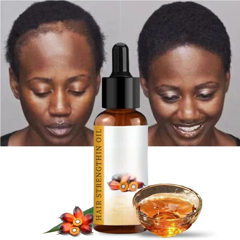 Lewedo Naturals Batana Olie Snelle Haargroei voor Mannen Vrouwen Pure Batana Olie Voeden Glanzend Haar Gezonde Haarverzorging Anti Haaruitval - afbeelding 2
