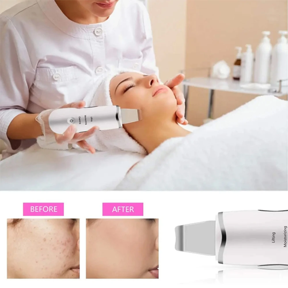 Thumbnail 4 - #13 Best Rated Electric Facial Massagers to Buy in 2026