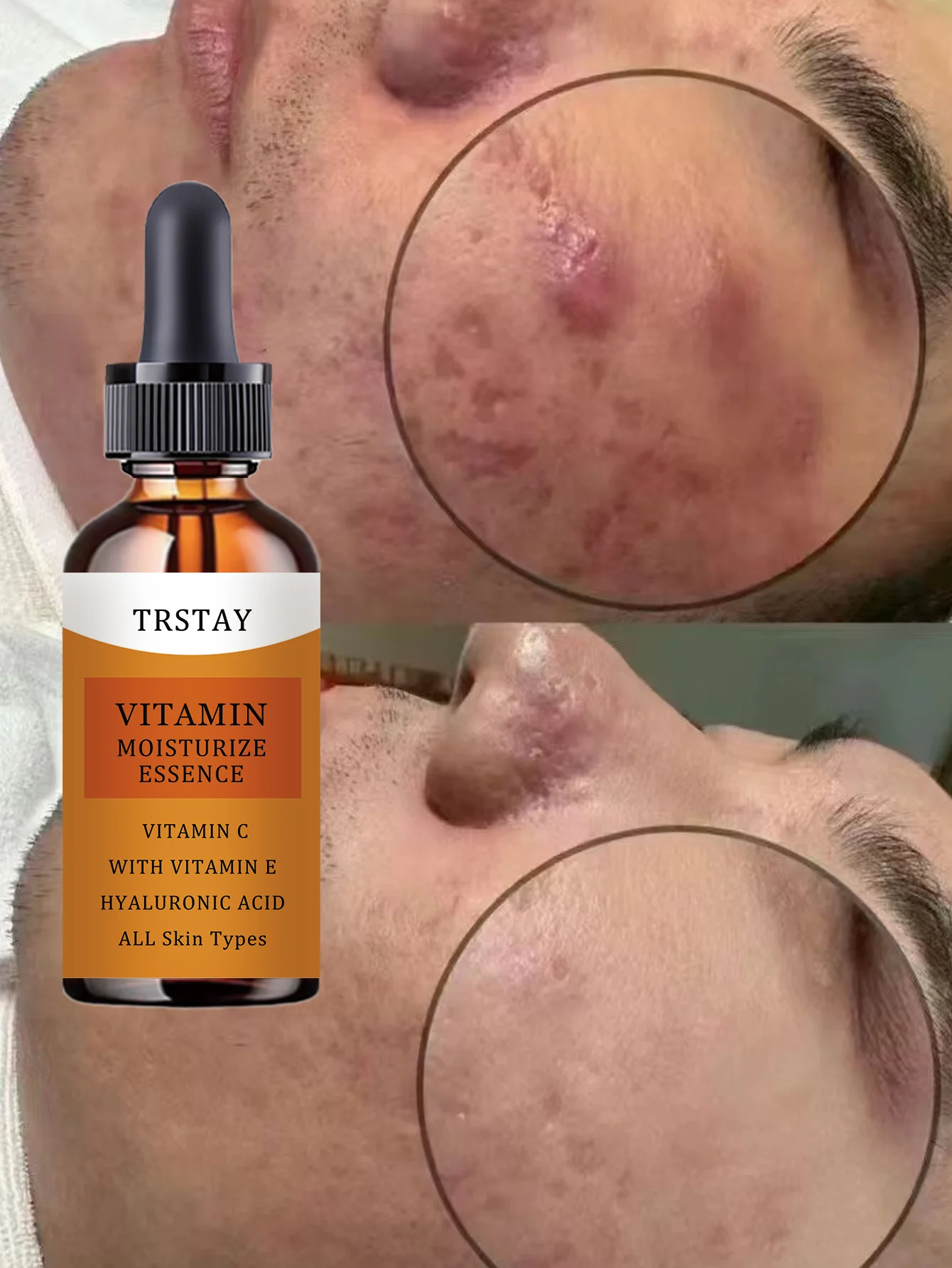 Hydrating Lightweight Nourishing Oil for Dehydrated Skin Deep Moisture Repair Serum with Natural Ingredients for Dry Sensitive S