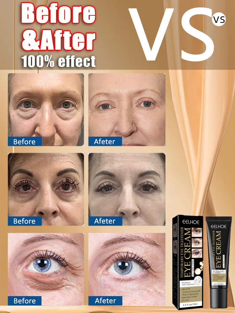 Crema para eliminar bolsas de ojos, Retinol, antiarrugas, reafirmante, decoloración de la piel, líneas finas, antiángulo oscuro, hinchazón, ilumina el cuidado de los ojos