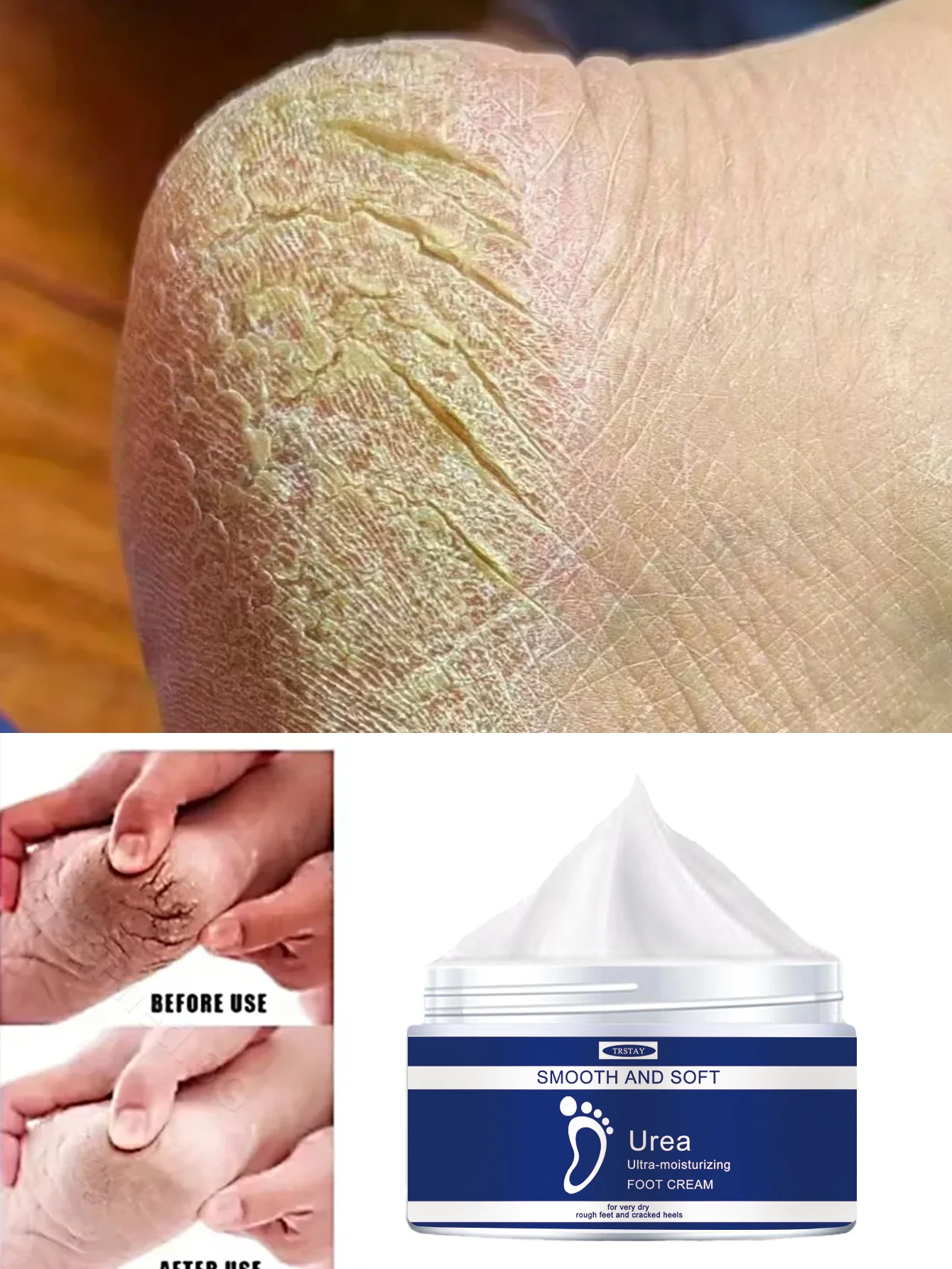 Crema hidratante profunda para pies para callos rechonchos y piel muerta, suavizante, delicado talón, reparación esencial, pies suaves para bebé, año ro