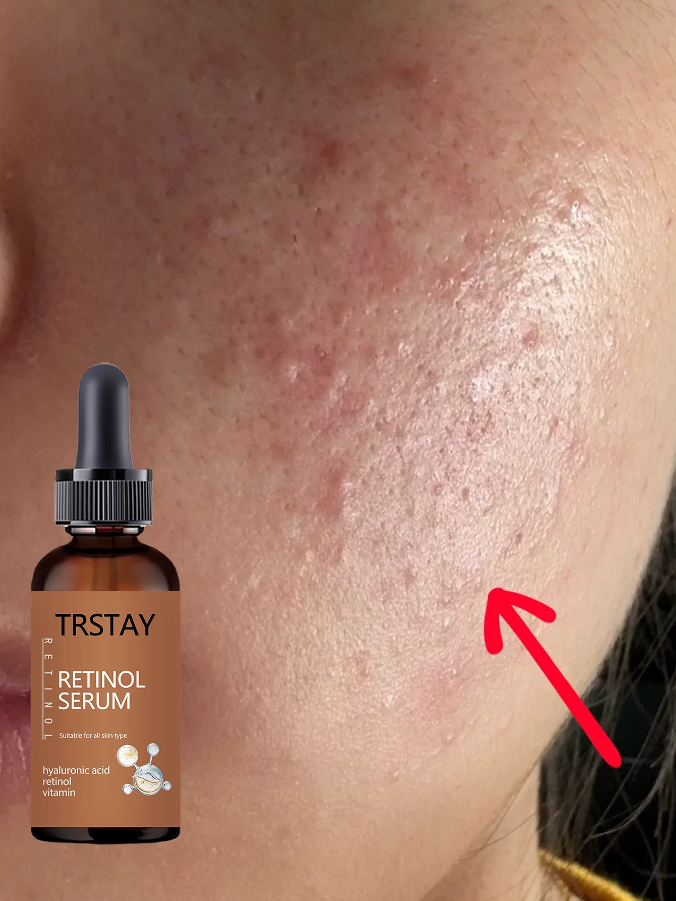 Hydrating Facial Oil for All Skin Types 24H Moisture Lock Nourishing Serum Instant Relief Essential Hydration Skin Care Treatmen - Image 5