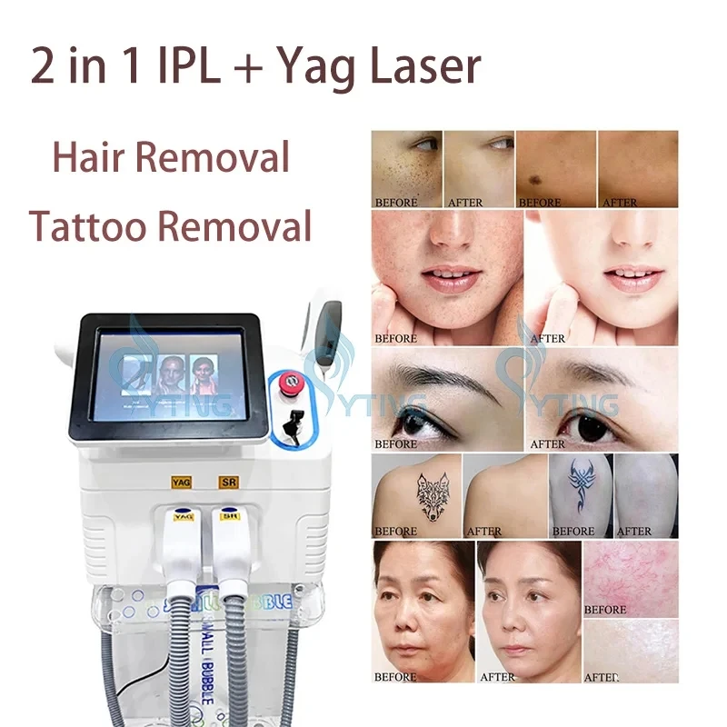 

360 Magnetic Optical OPT IPL Laser Hair Removal Acne Treatment Skin Rejuvenation Nd Yag Laser Tattoo Removal Machine