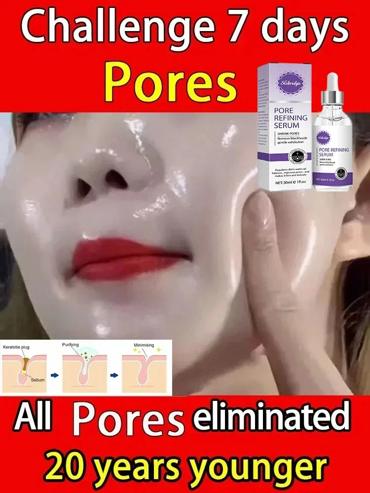 

Solve Large Pore Problems