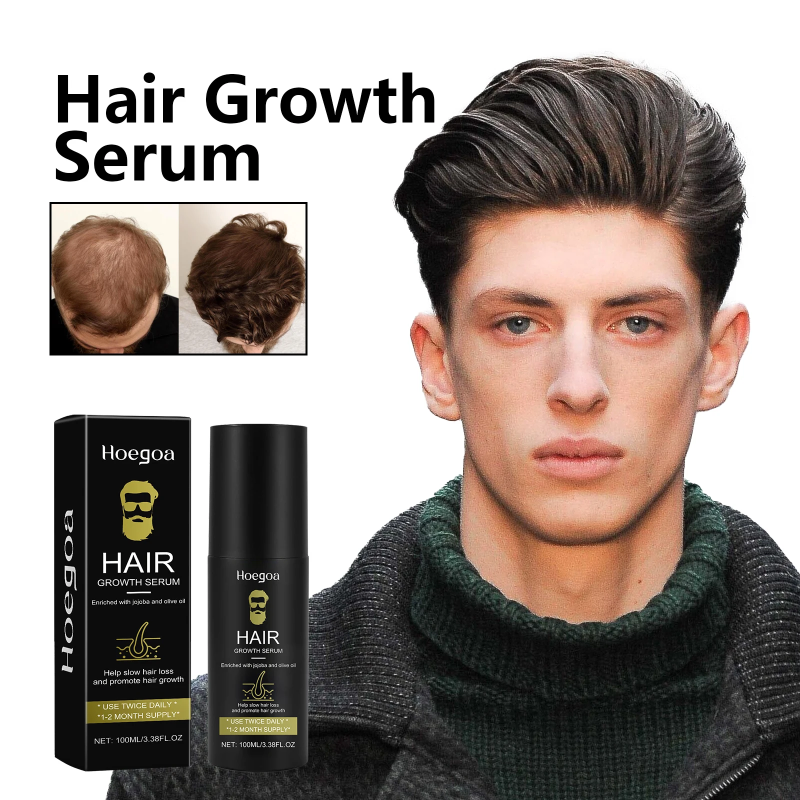 Hoegoa 100 مللي رذاذ نمو الشعر للرجال تغذي جذور الشعر مكافحة الصلع تدليك تقليل التجعد سبليت ينتهي رذاذ العناية بالشعر الكثيف #2