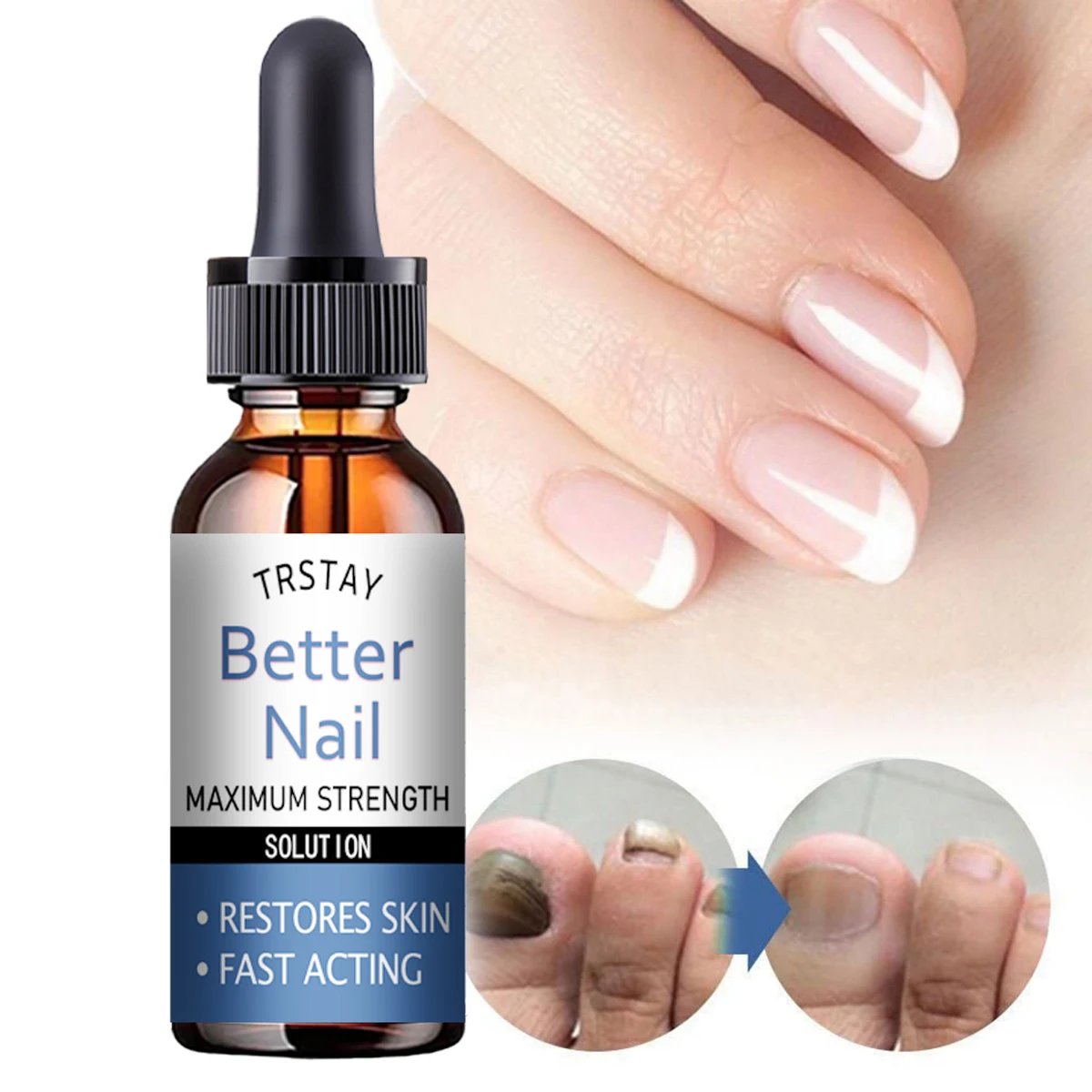 زيت مغذي لزوائد الأظافر من TRSTAY 50 مل يغذي ويصلح الأظافر التالفة وترطيبها ويقوي ويضيء العناية بالأظافر