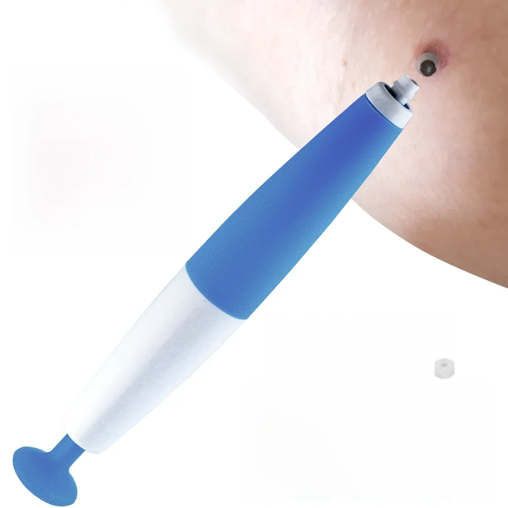 Haut Tag Töten Haut Maulwurf Warze Remover Micro Haut Tag Entfernung Kit Mit Reinigung Tupfer