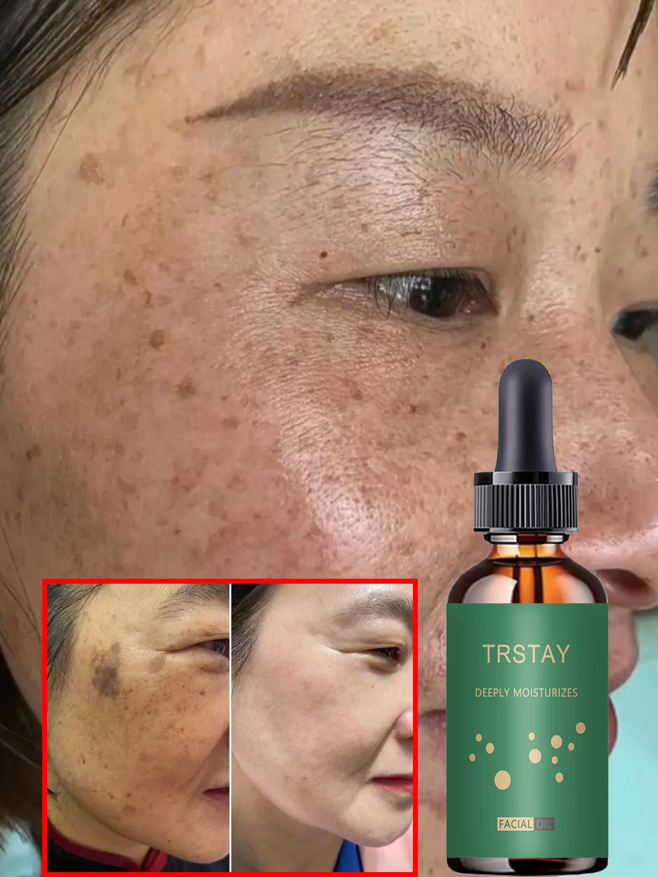 Facial Moisturizing Serum - Gentle and Non-Irritating, With Plant Extracts, Hydrating and Moisturizing, Suitable for All Skin Ty - Image 3