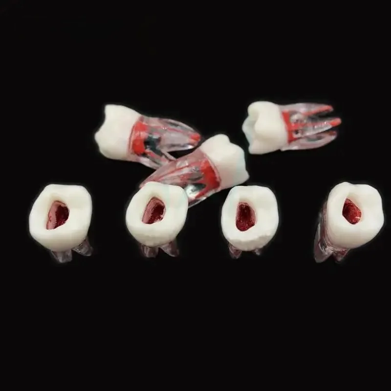 1Pc Dental model zęba kanał korzeniowy RCT praktyka miazga jamy wyczyść żywica nauczanie model zębów 1:1 Model dentystyczny dentysta narzędzia — zdjęcie 2