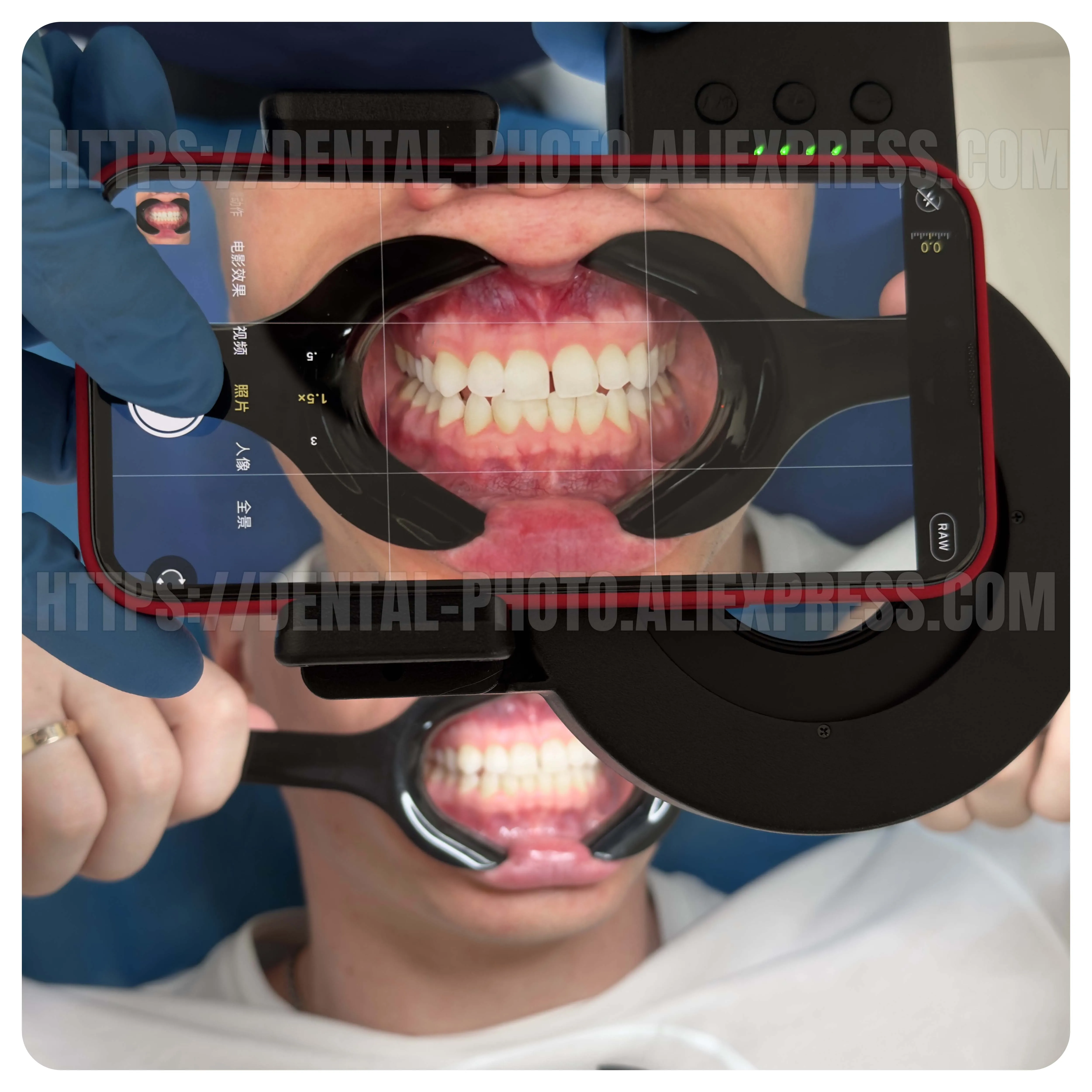 MK-023 Dentist Photography Ring Fill Light  Adjustable 2500-6500K 3-Color Temperature, Soft Diffuser, Oral & Intraoral Photo fo