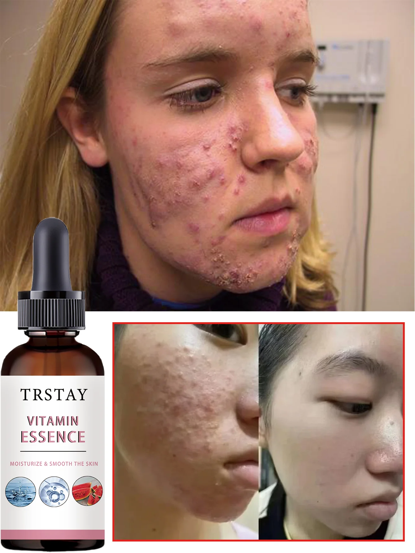 Hydrating Facial Oil Deep Nourishment Serum Relieves Dry Tightness for Smooth Glowing Skin Moisturizing Treatment with Natural I - Image 3