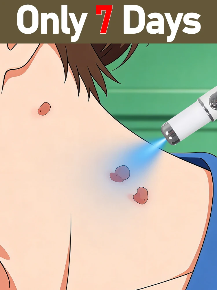 Mole removal pen, used to remove skin growths, warts, and blemishes, creating smooth, healthy skin.