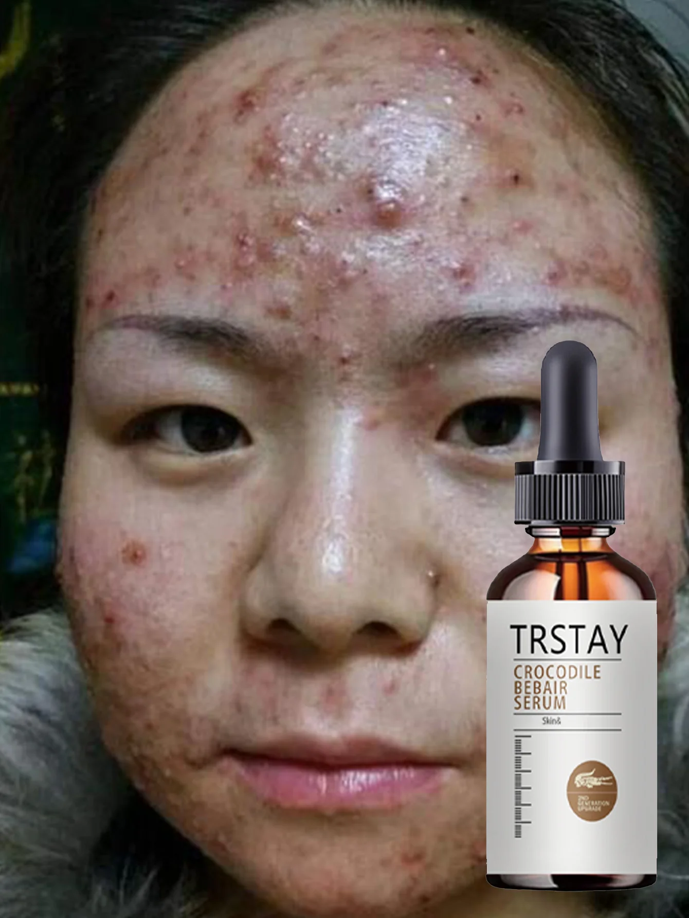 Moisturizing Essential Oil for Skin Hydration and Firming with Natural Extracts to Improve Elasticity and Reduce Wrinkles for Yo - Image 4