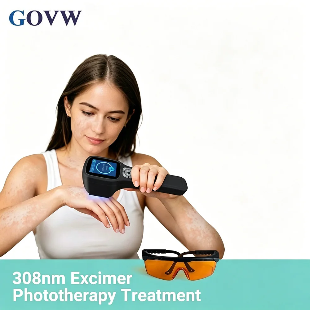 GOVW Rechargeable Handheld UVB Excimer Lamp 308nm with 49 Diodes Precision Target Light Therapy Device for Vitiligo Psoriasis