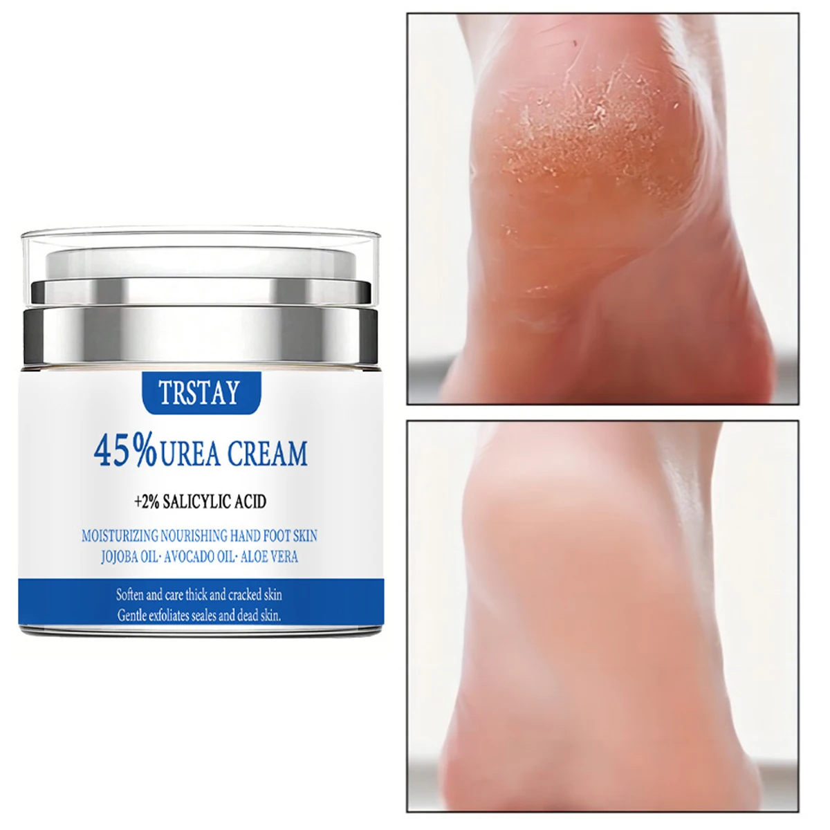 

TRSTAY 45% крем мочевины +2% салициловая кислота увлажняет и питает кожу рук и ног с маслом жожоба, масло авокадо и алоэ вера.