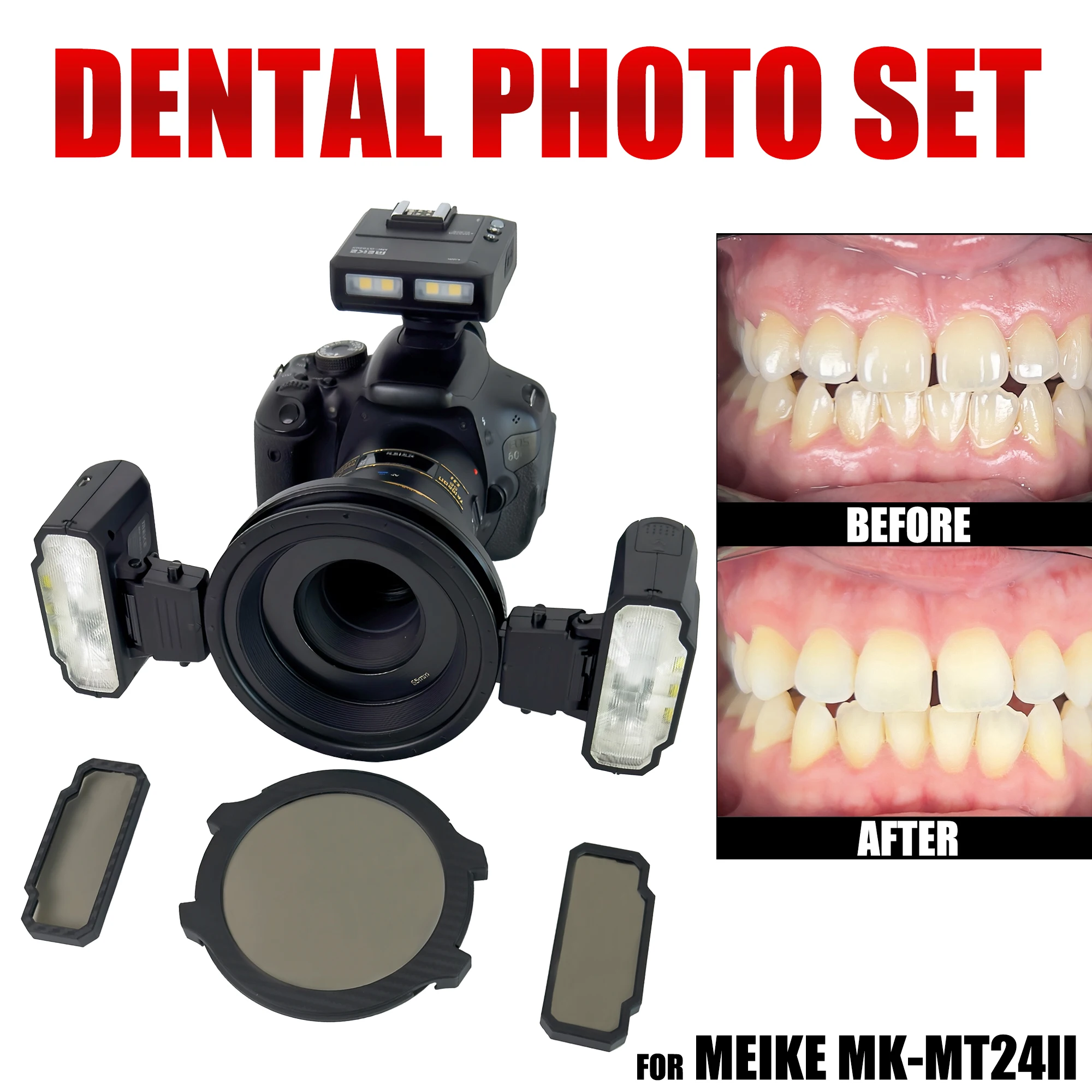 

Cross Polarizing Lens for Meike MK-MT24. Filter for Dental Photos, Dental Photography Polar Eye Photos, No Glare, No Relfection