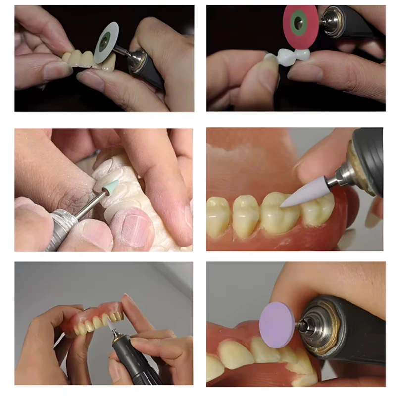 Dental Equipment RA0109 High Quality Amalgam Polishing Kits Dental Low Speed Dental Handpiece Use Diamond Burs Three Colors Bur