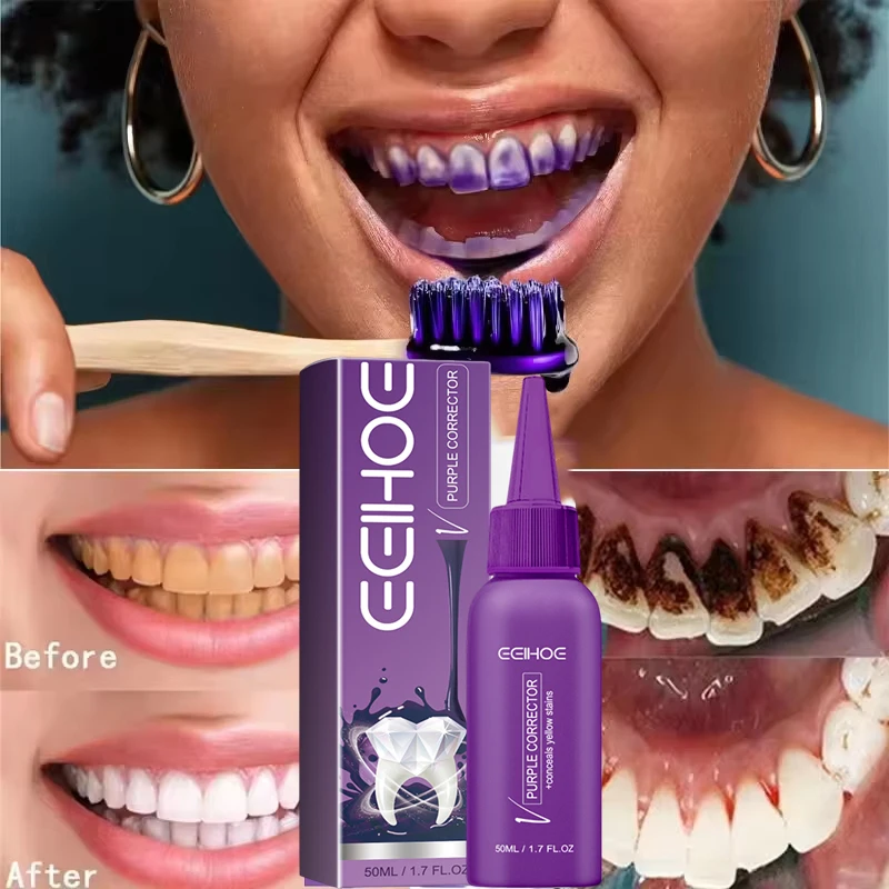 محلول تبييض الأسنان الأرجواني القوي، عامل تبييض تنظيف الأسنان الطبيعي يزيل الأسنان الصفراء وينعش التنفس #1