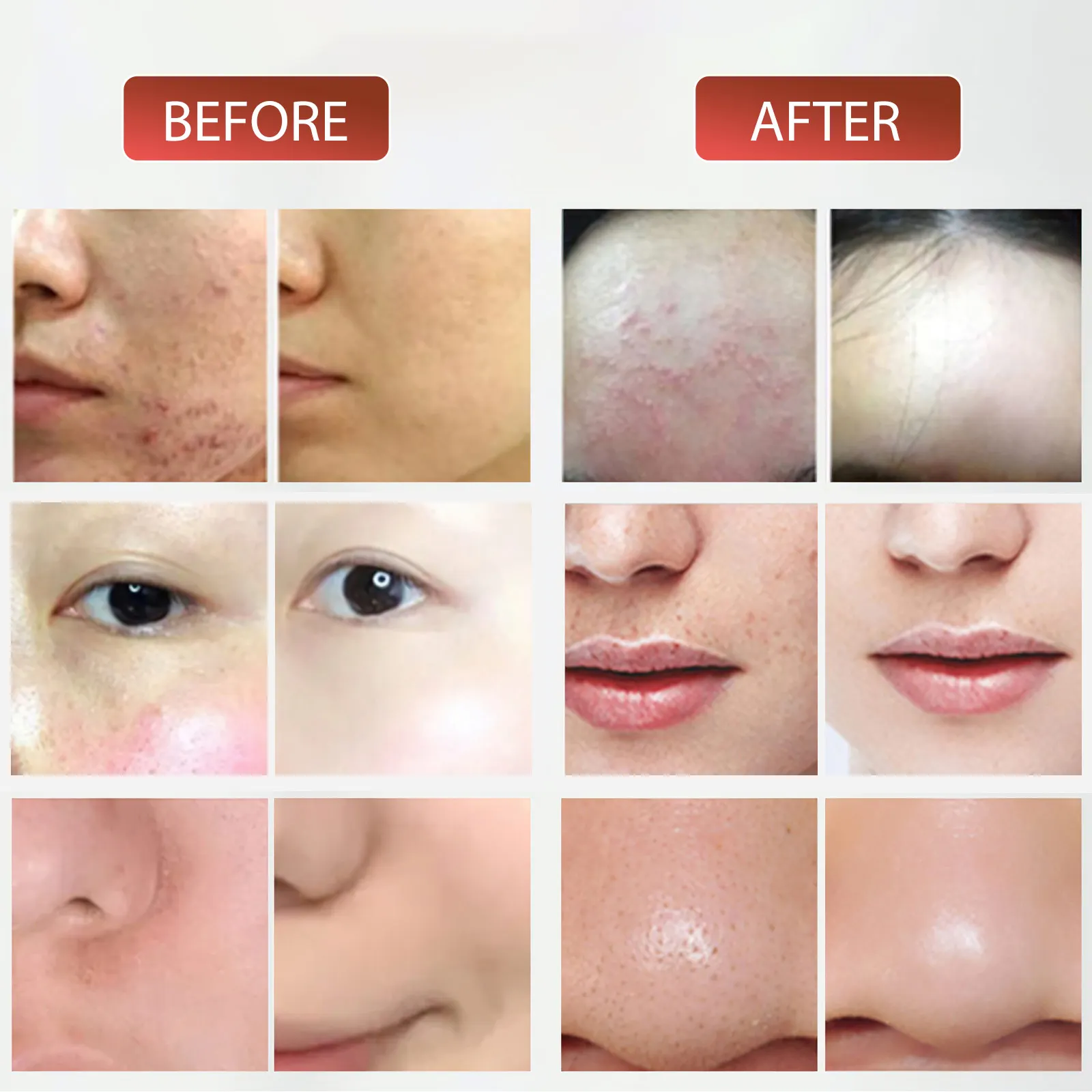 DWiusty 7-Farben LED-Photonen-Gerät mit Nano-Spray zur Hautbefeuchtung, Gesichts- und Körpermaske für Salon, SPA und Heimgebrauch, Hautverjüngung, Akne-Hautpflege – Detail 6