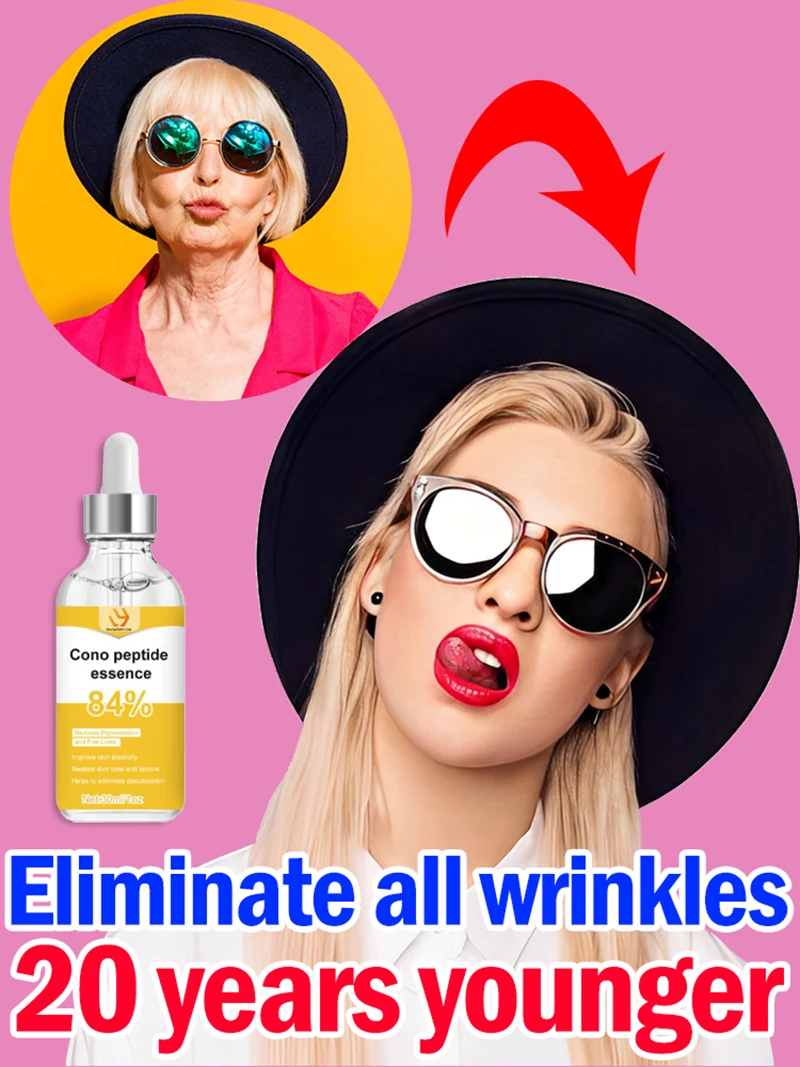 Wrinkle Lifting for Deep Wrinkles
