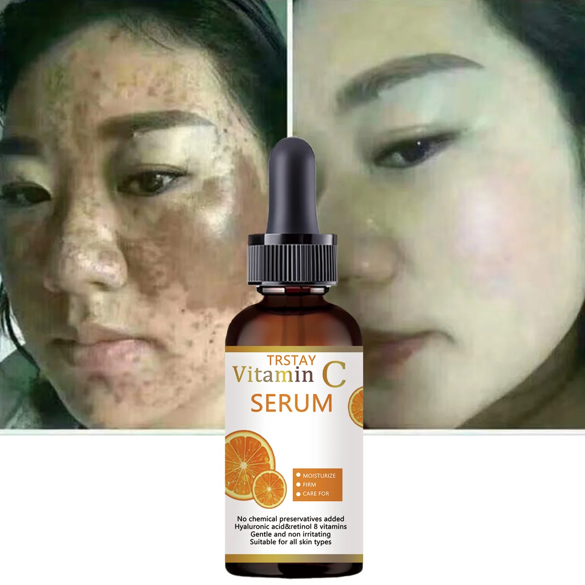 Moisturizing anti aging serum for fine lines and dry lines reduction spot lightening essence liquid nourishes smooth glossy skin - Image 3