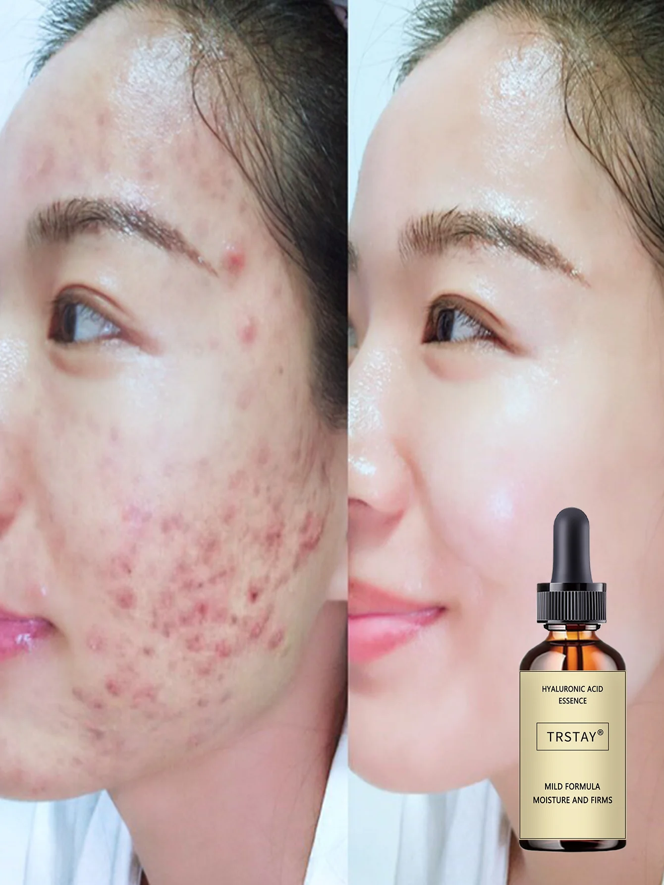 Hydrating Water Light Facial Oil for All Skin Types Deep Moisturizing Nourishing Serum with Natural Extracts Lightweight Non Gre - Image 5