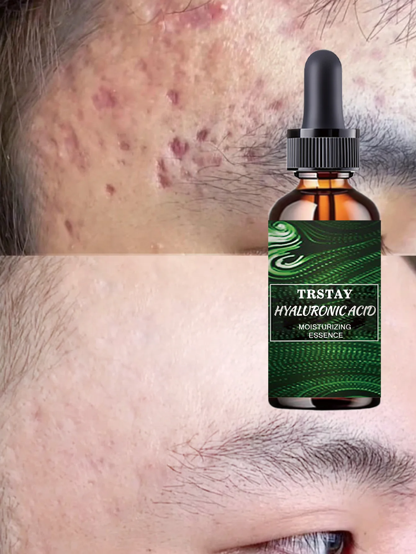Hydrating Deep Nourishment Oil Control Pore Minimizer Revitalizing Complexion Even Skin Tone Anti Aging Solution for All Skin Ty - Image 2