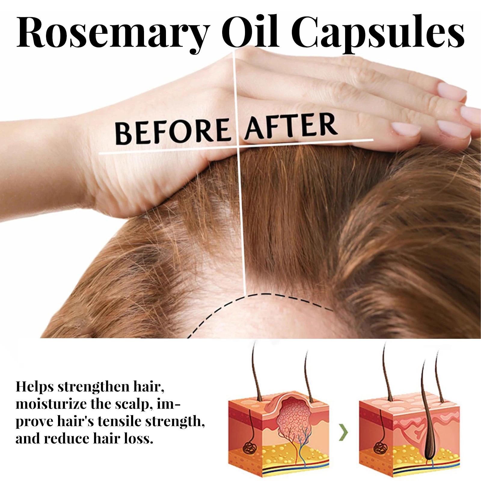 Eelhoe Rosemary Hair Care Capsule Hair Care Nourishes Roots Prevents Hair Loss And Moisturizes Hair Care Essential Oil