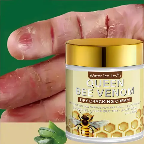 Queen Bee Venom Trockene Risscreme mit Retinol und Niacinamid – intensiv feuchtigkeitsspendend für Hände, Füße und Körper. Repariert trockene Haut.