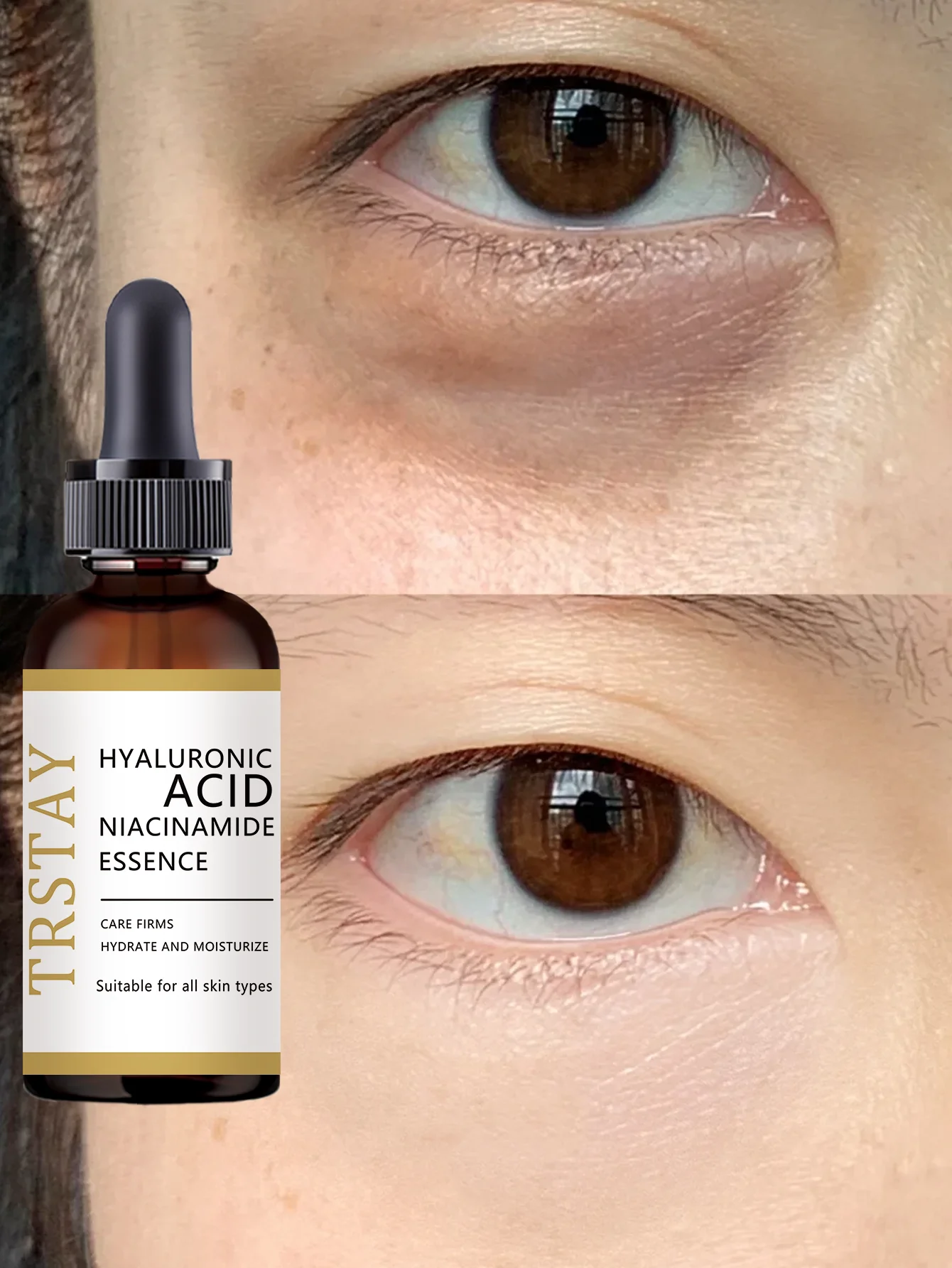 Moisturizing Glycerin Eye Oil for Brightening Hydration and Dark Circle Reduction with Natural Ingredients for Sensitive Skin Ca